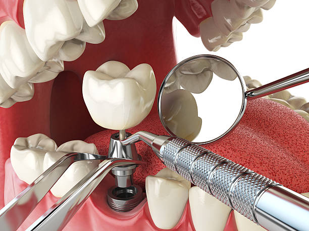 Best Urgent Dental Care in Bonny Doon, CA